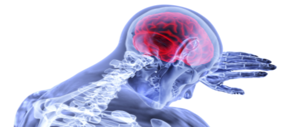 1_brain